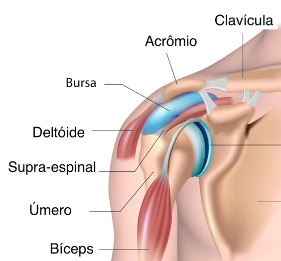 O que Causa a Bursite no Ombro? sintomas